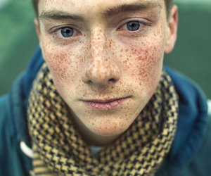 как избавиться от веснушек на лице навсегда