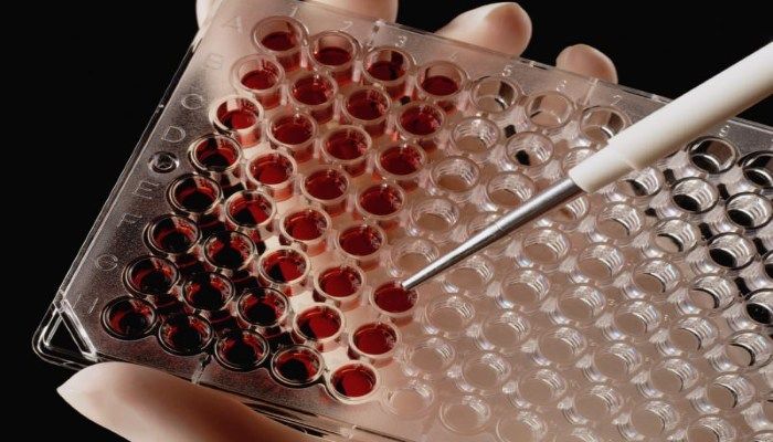 Анализ крови