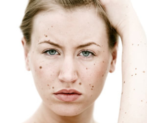 родинки на теле значение фото