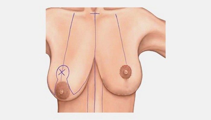 Сильная асимметрия