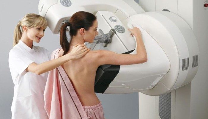 Маммография