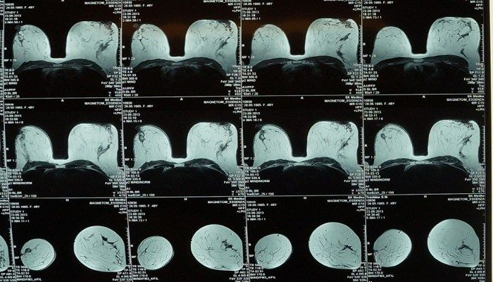 Рентген снимки