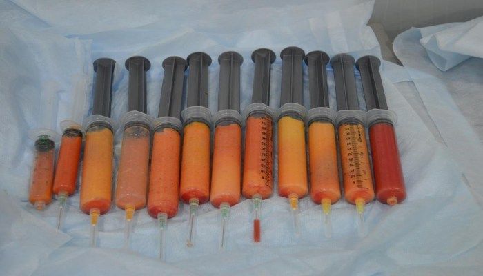 Материал для процедуры