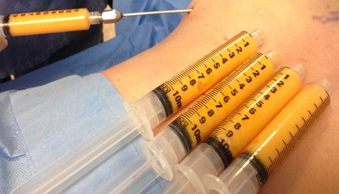 Процесс липофилинга