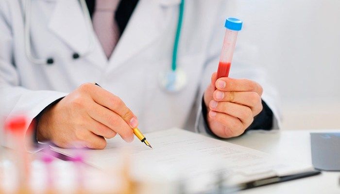 Результаты анализов