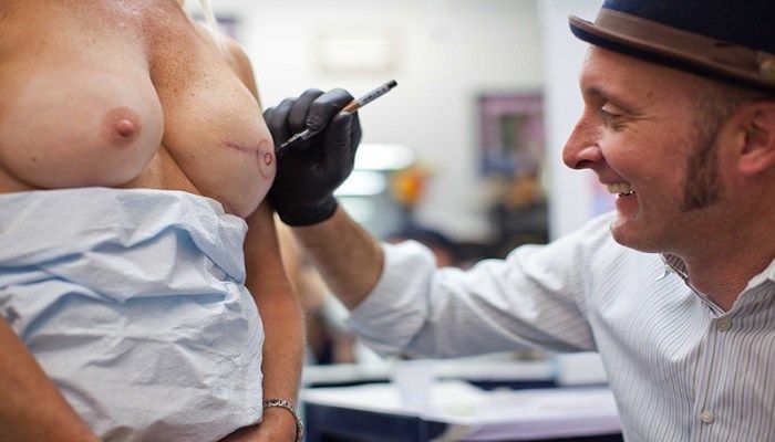 Восстановление соска