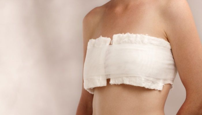 Реабилитация после мастэктомии