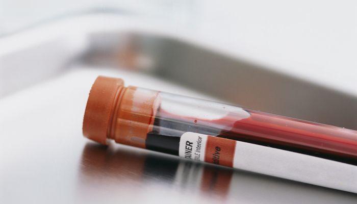 анализ крови анализ крови