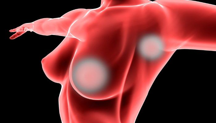 Железа подмышкой