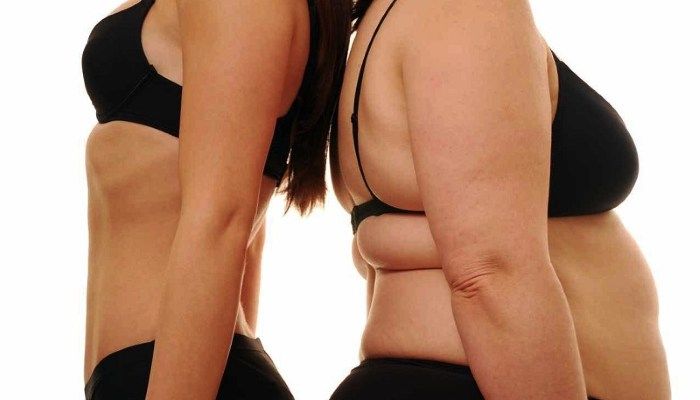 Избыточный вес