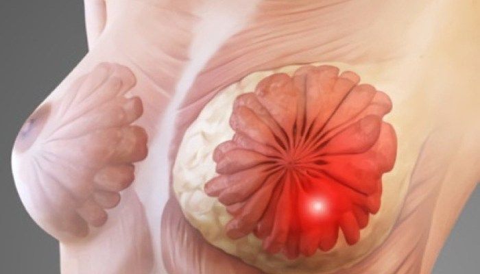 Воспаление