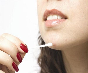 спиртовой раствор салициловой кислоты