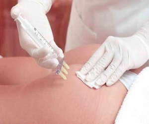 мезотерапия в домашних условиях