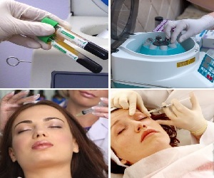 плазмолифтинг фото до и после