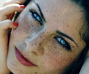 как убрать веснушки с лица