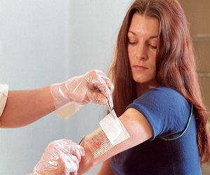 флегмона ноги