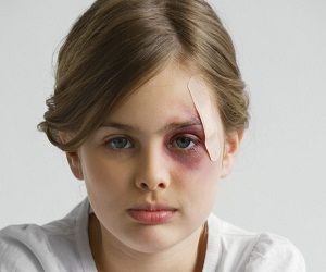 темные круги под глазами у ребенка причины