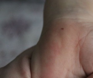 родинка на ладони левой руки