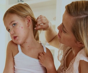 методы лечения пиодермии у детей