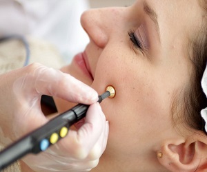 как избавиться от следов после прыщей