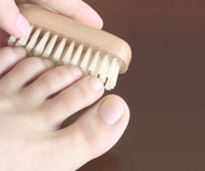 микоз ногтей