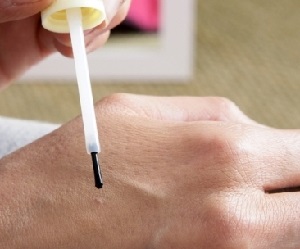 чистотел отзывы