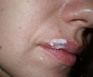 ацикловир крем