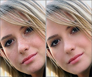 веснушки фото