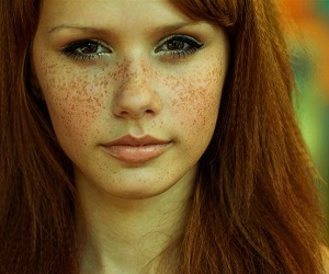 веснушки на лице