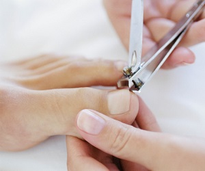 вросший ноготь фото