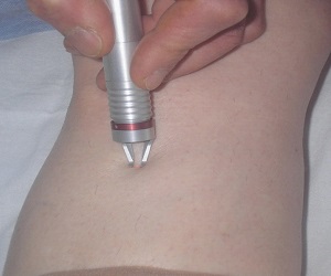 конттагиозный моллюск у детей