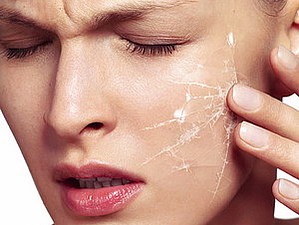 сухая кожа тела фото