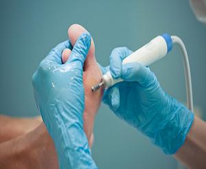 натоптыши на ступнях ног фото