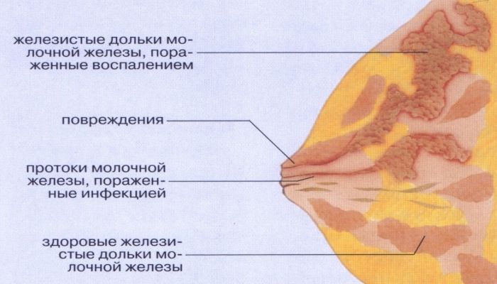 Строение МЖ