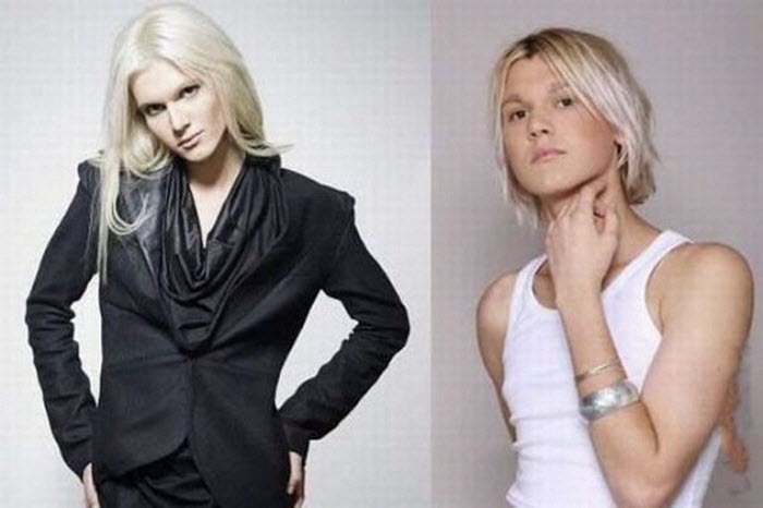 Внешние признаки синдрома Морриса