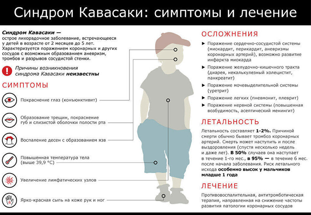 Симптомы синдрома Кавасаки