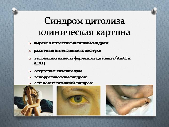 Синдром цитолиза