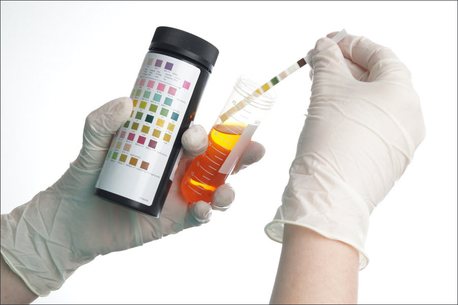 Анализ мочи