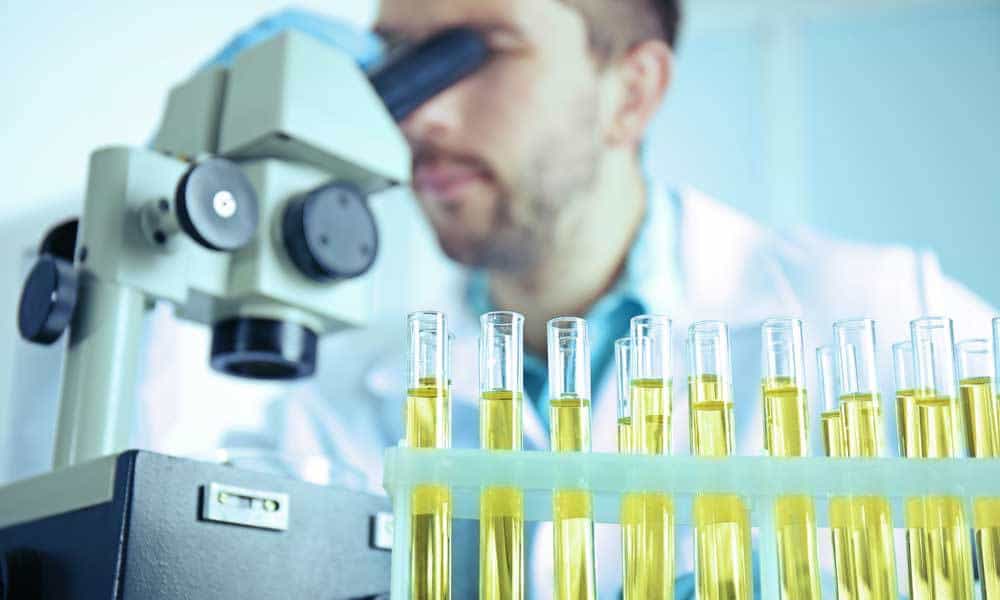 Анализ урины