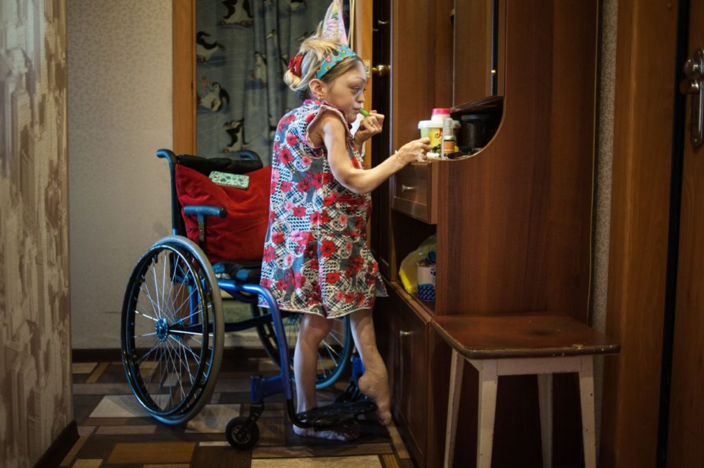 Девушка с синдромом Олбрайта