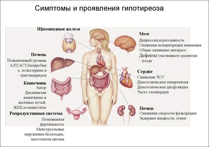 Симптомы гипотиреоза