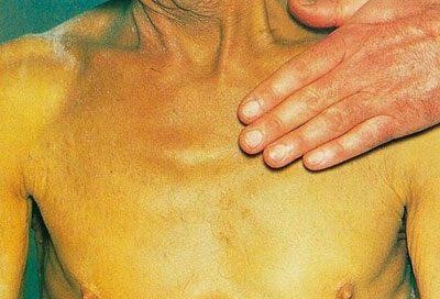 Желтый цвет кожи