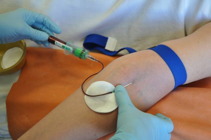 Забор венозной крови Забор венозной крови
