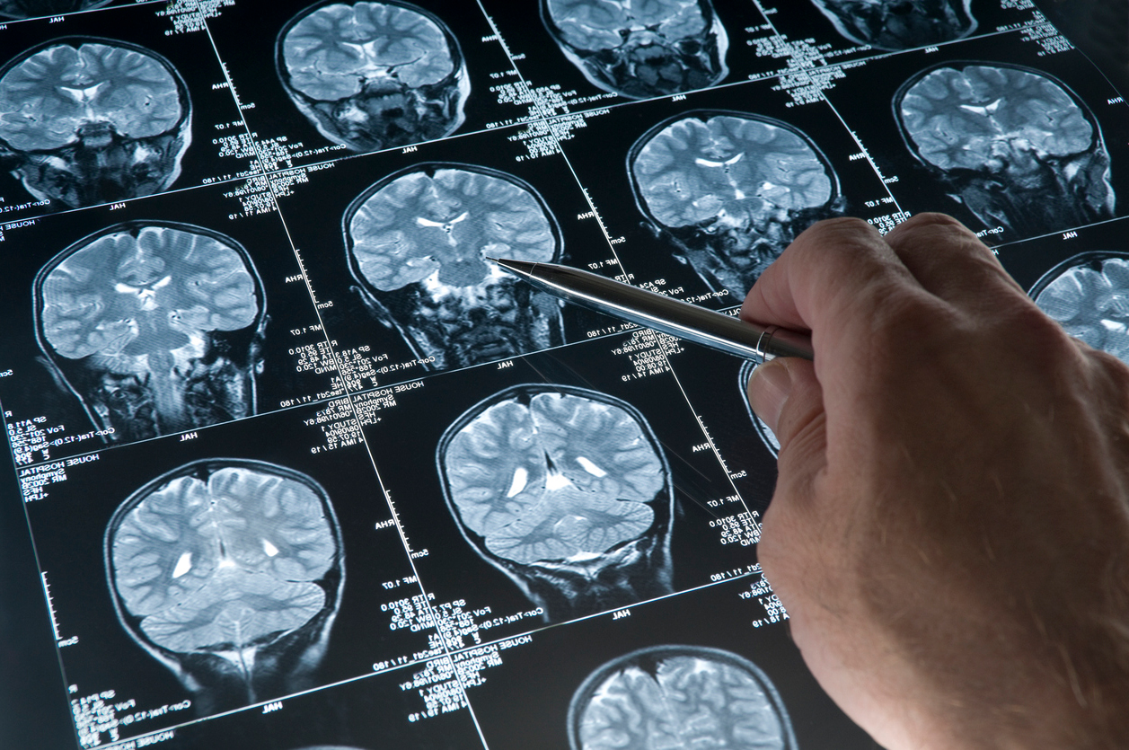 Диагностика мозга