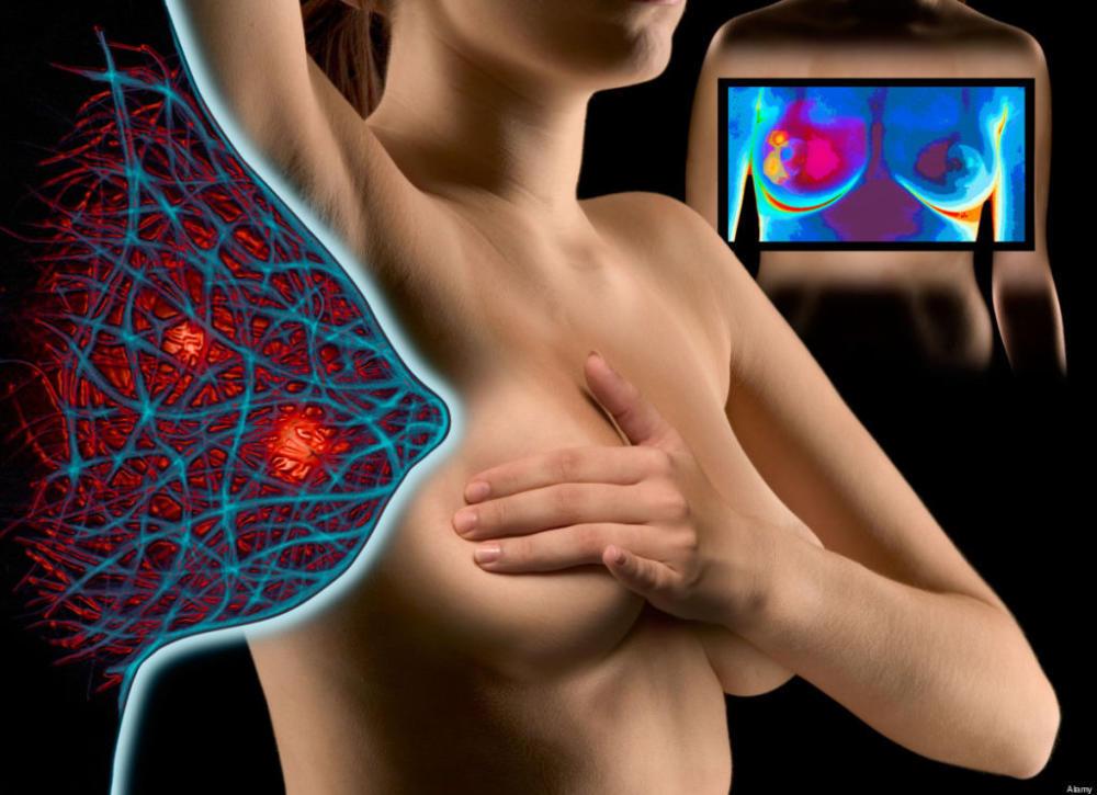 Диагностика мастопатии Диагностика мастопатии