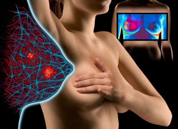 Диагностика фиброаденомы Диагностика фиброаденомы