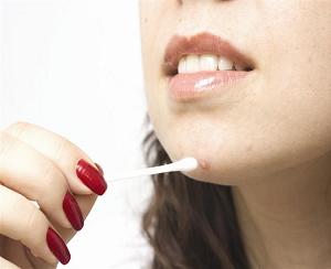 плоские бородавки лечение фото