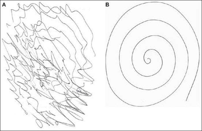 Письмо при треморе рук