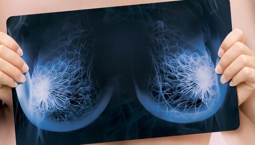 Снимок груди Снимок груди