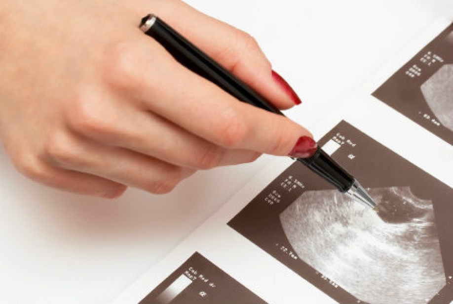 УЗИ яичников